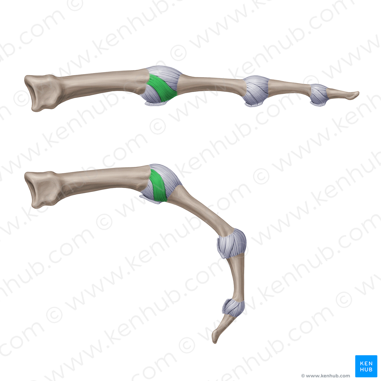 Proper collateral metacarpophalangeal ligaments (#20948)