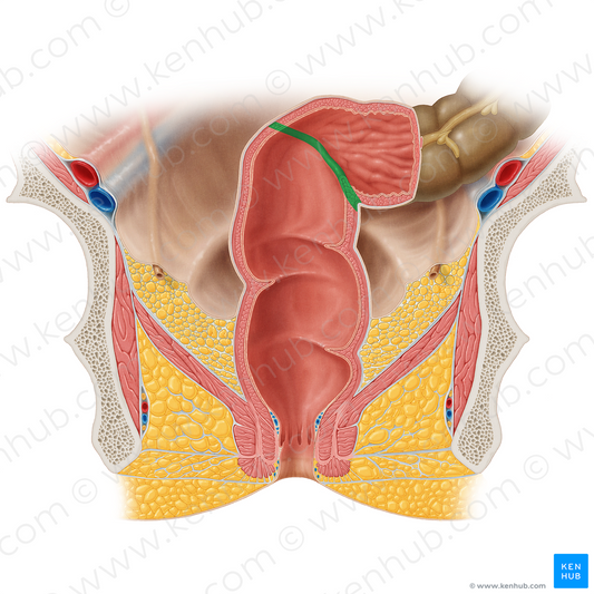 Rectosigmoid junction (#20521)