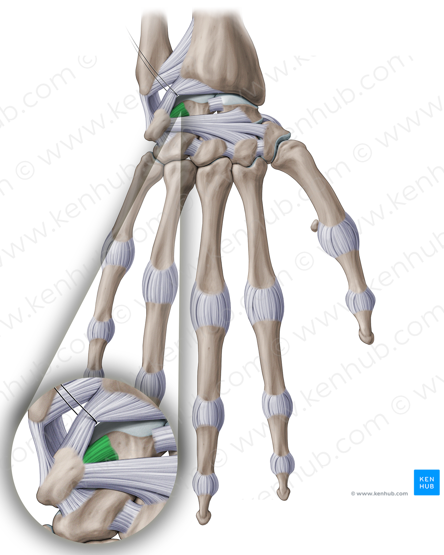 Lunotriquetral interosseous ligament (#18907)