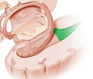 Occipital horn of lateral ventricle (#2872)