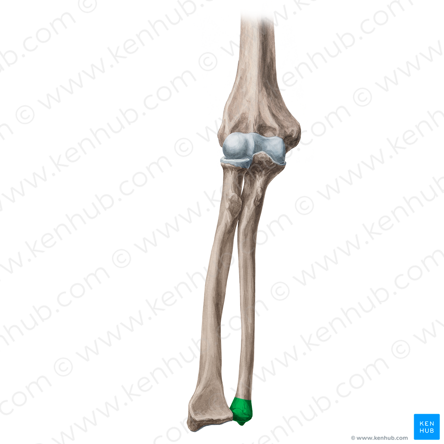 Head of ulna (#21347)