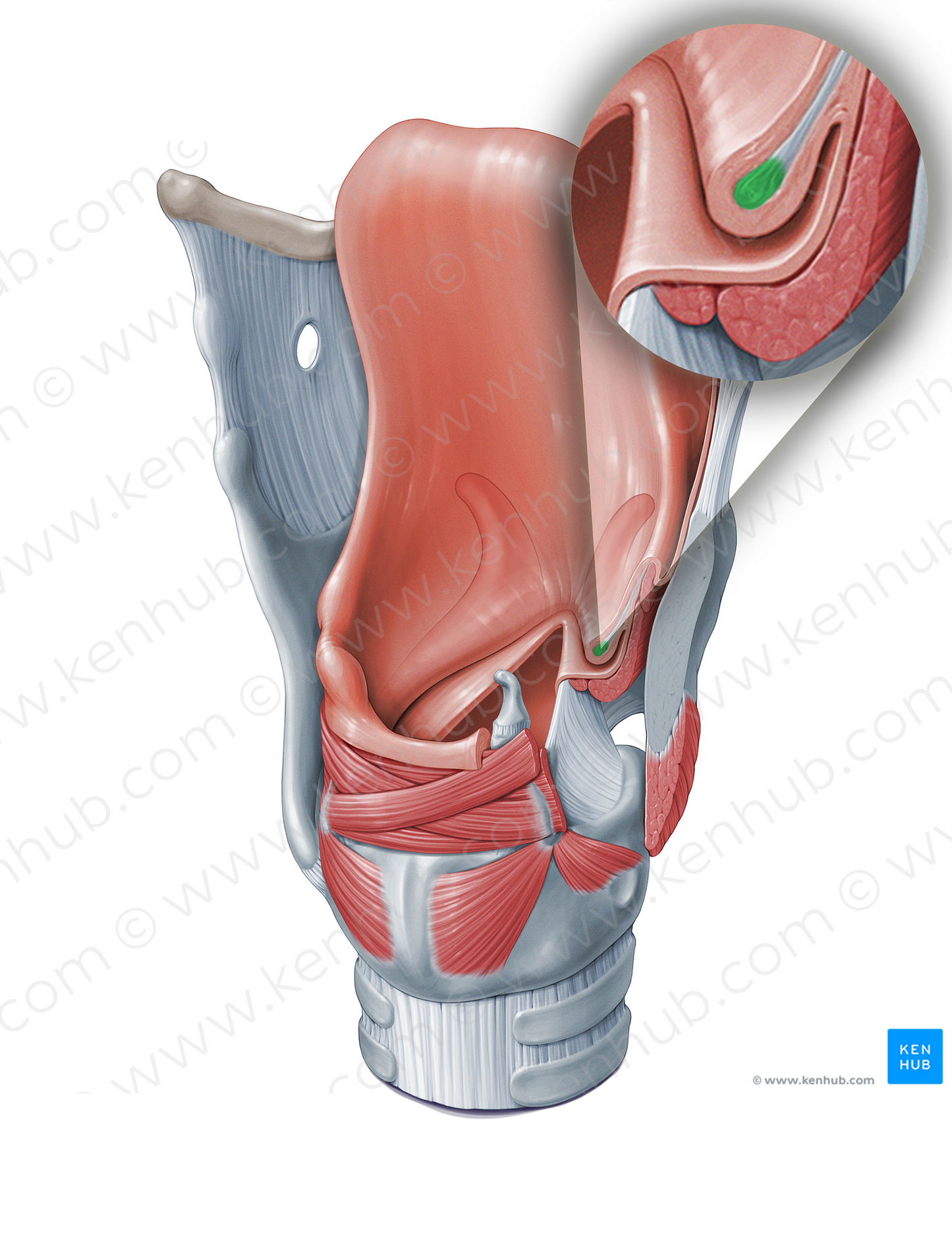 Vestibular ligament (#18366)