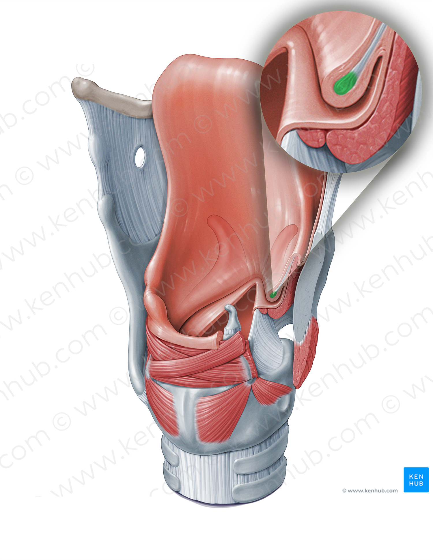 Vestibular ligament (#18366)