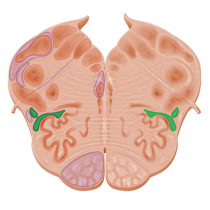 Spinothalamic tract (#11097)