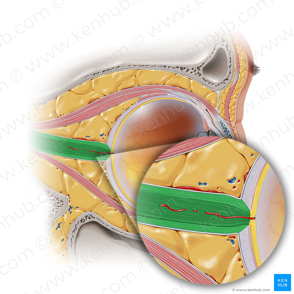 Optic nerve (#6648)