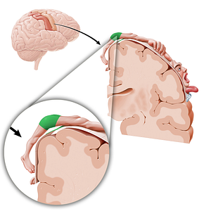 Motor cortex of hip (#11075)