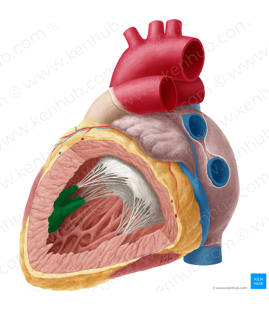 Superior papillary muscle of left ventricle (#5712)