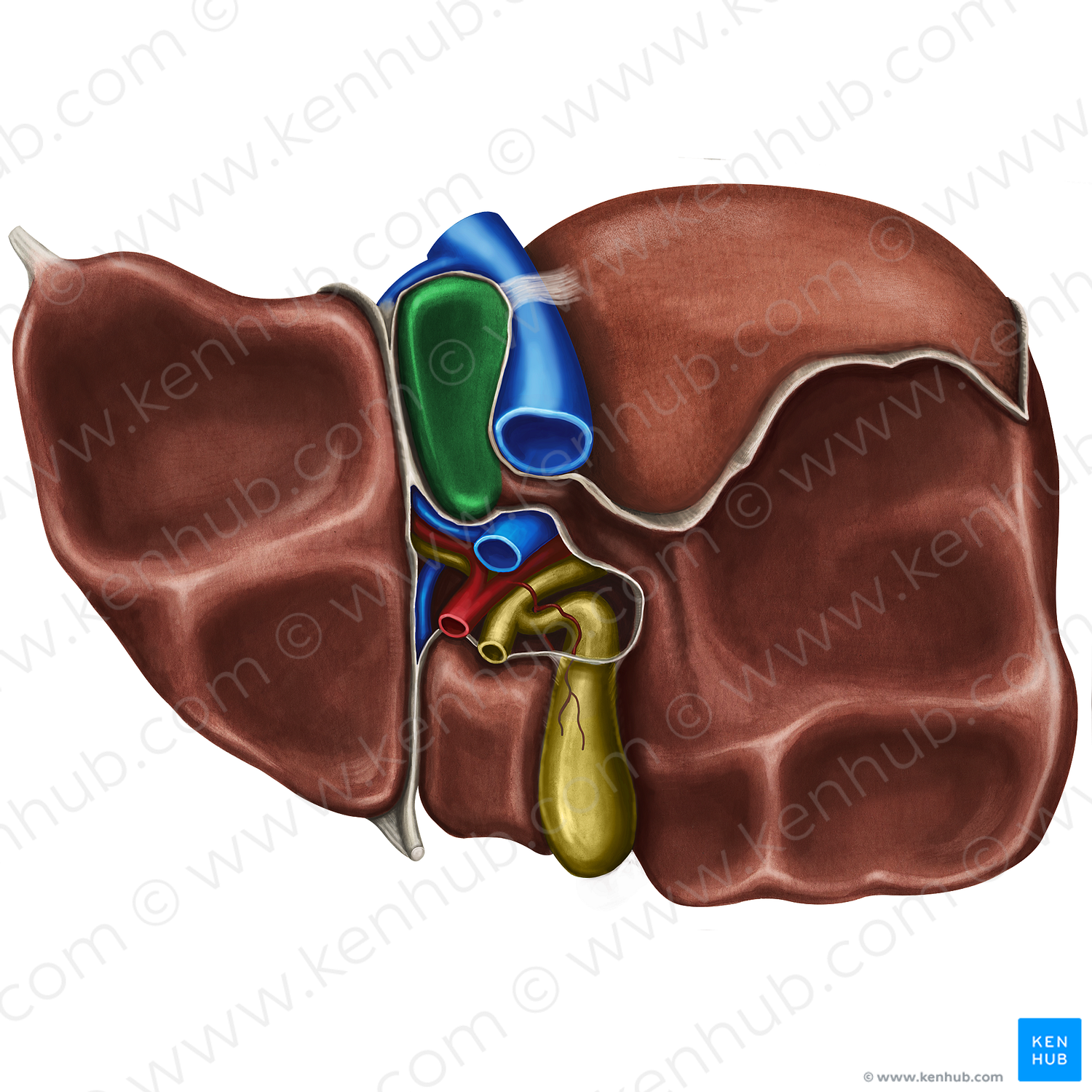 Caudate lobe of liver (#4775)