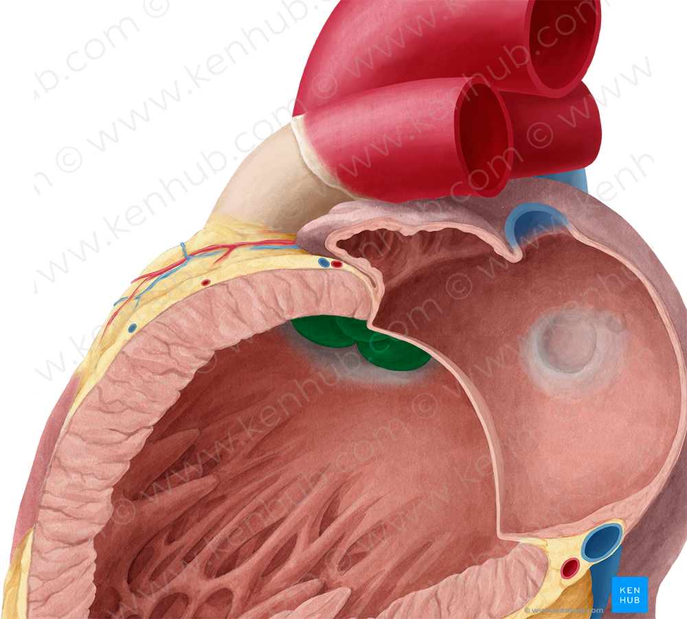 Aortic valve (#9894)