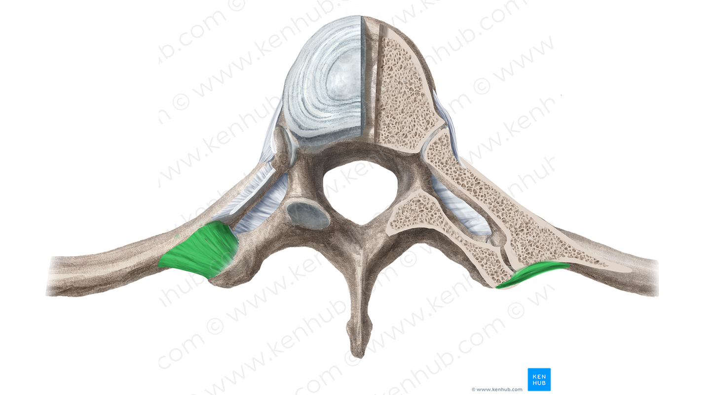 Lateral costotransverse ligament (#11382)