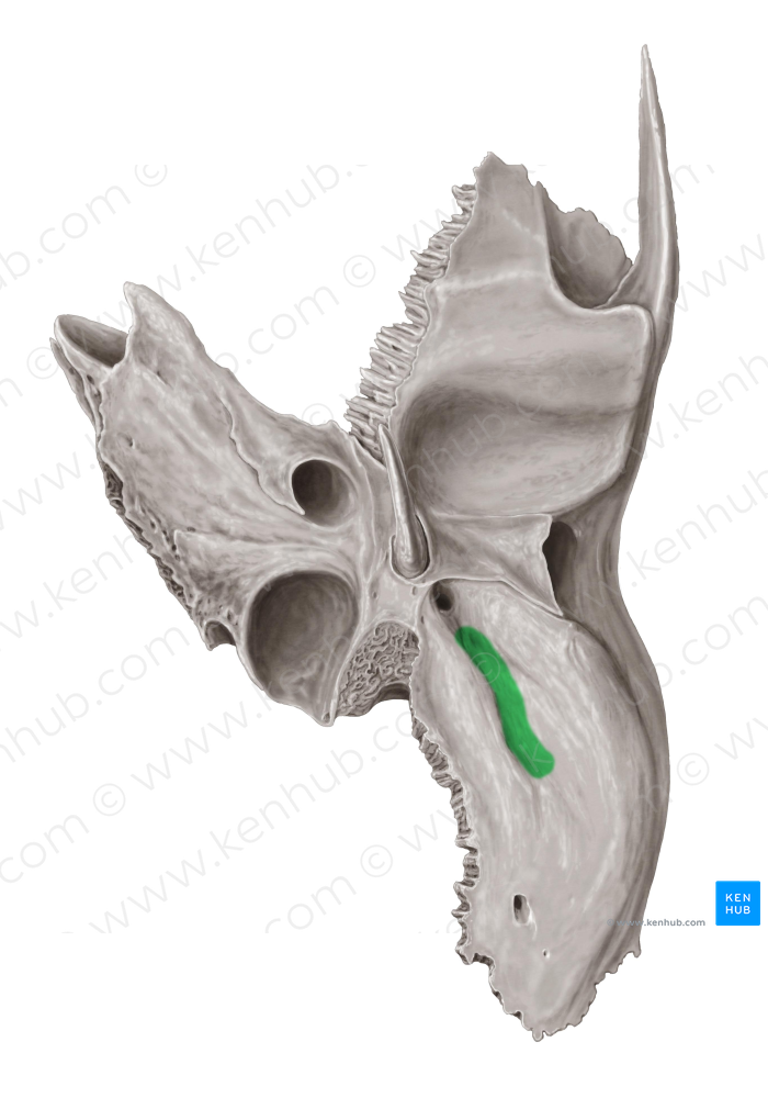 Mastoid notch of temporal bone (#4302)