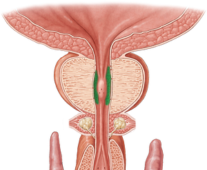 Prostatic ductules (#3292)