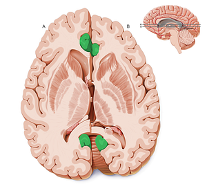 Cingulate gyrus (#4169)