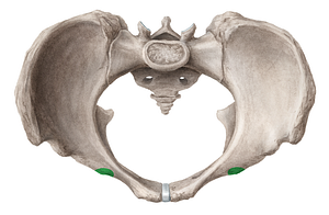 Iliopubic eminence of hip bone (#3383)