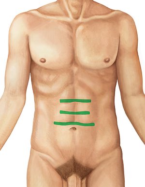 Tendinous intersections of rectus abdominis muscle (#4324)