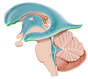 Right lateral ventricle (#10714)