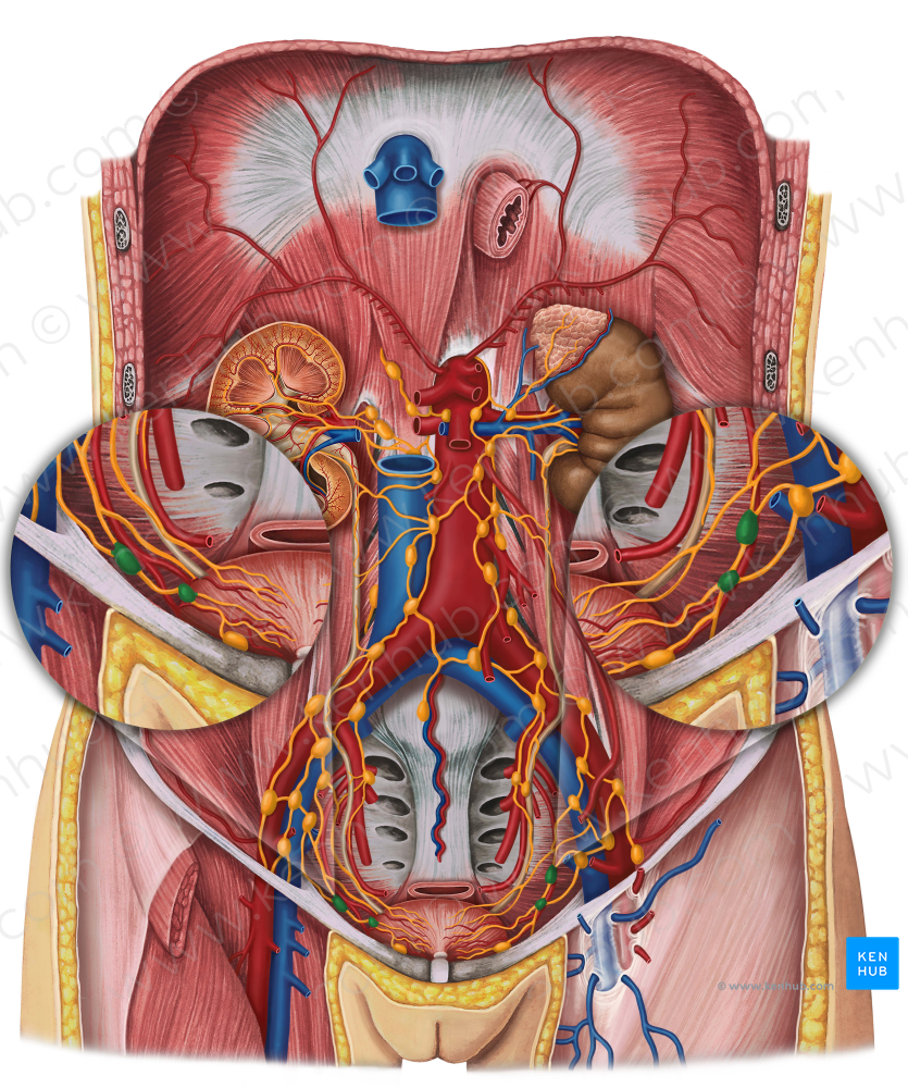 Lateral vesical lymph nodes (#7129)