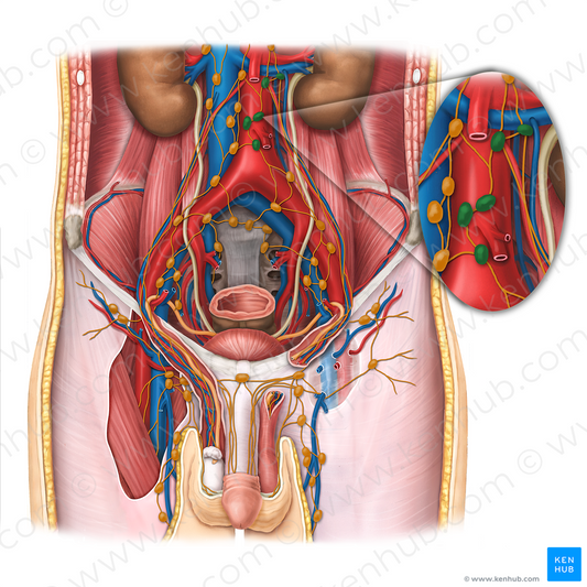 Left lumbar lymph nodes (#7050)