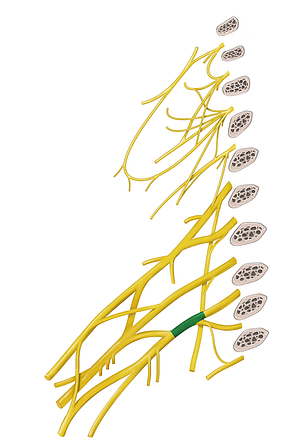 Inferior trunk of brachial plexus (#9619)