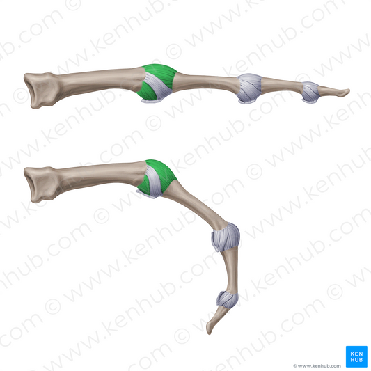 Accessory collateral metacarpophalangeal ligaments (#20946)