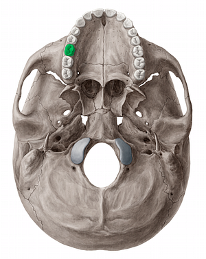 Maxillary right first molar tooth (#12828)