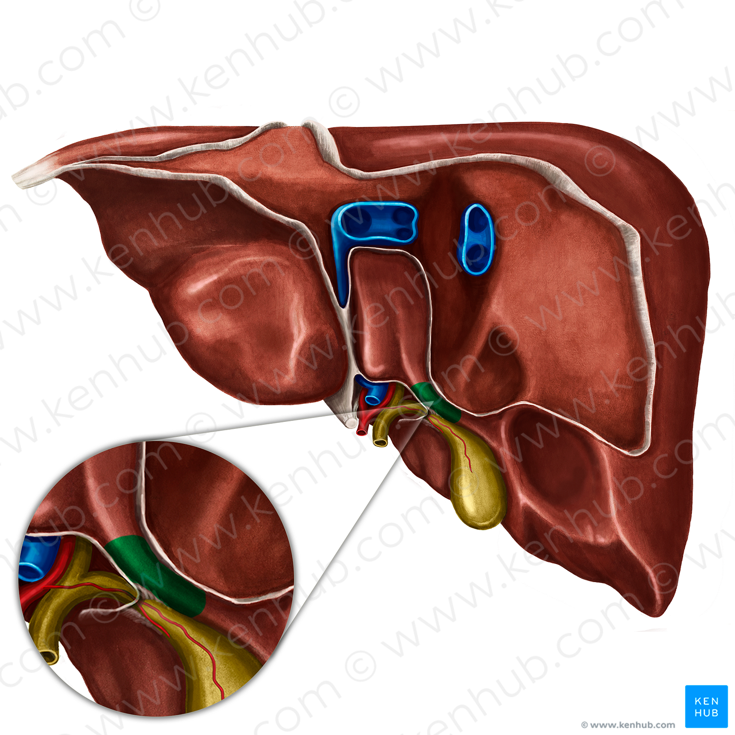 Caudate process of liver (#8179)