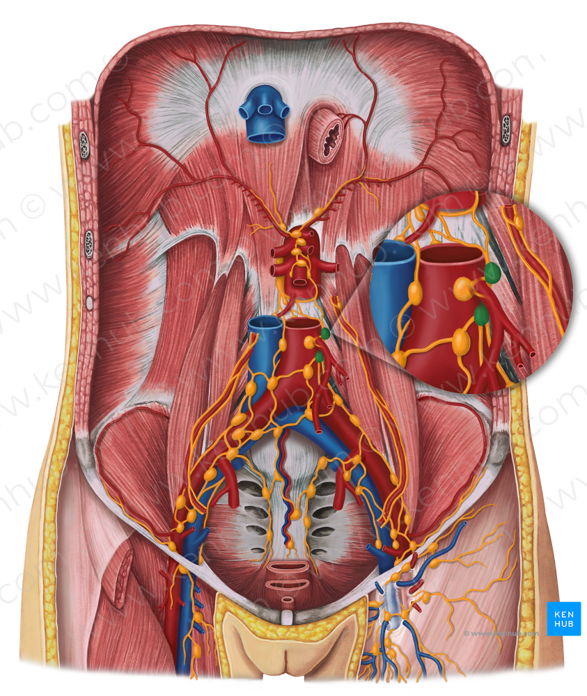 Lateral aortic lymph nodes (#6954)