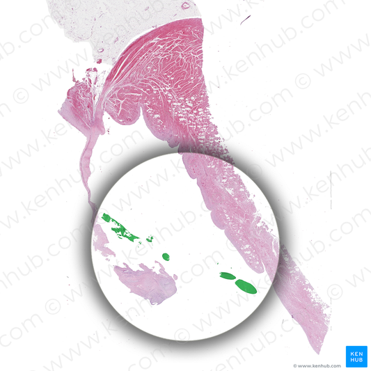 Tendinous cords of left atrioventricular valve (#2608)