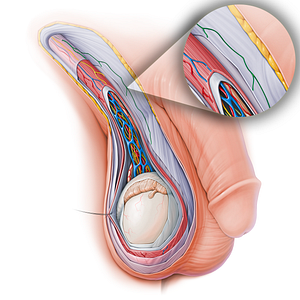 Anterior scrotal branch of ilioinguinal nerve (#15148)