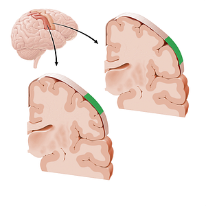 Sensory and motor cortex of face (#21216)