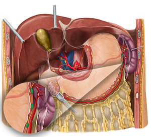 Left gastroomental lymph nodes (#7003)