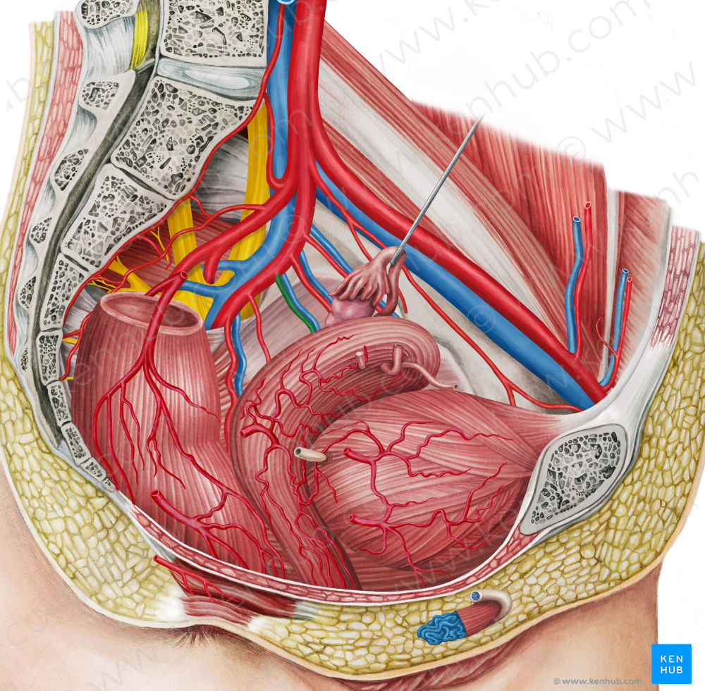 Left inferior vesical artery (#1984)