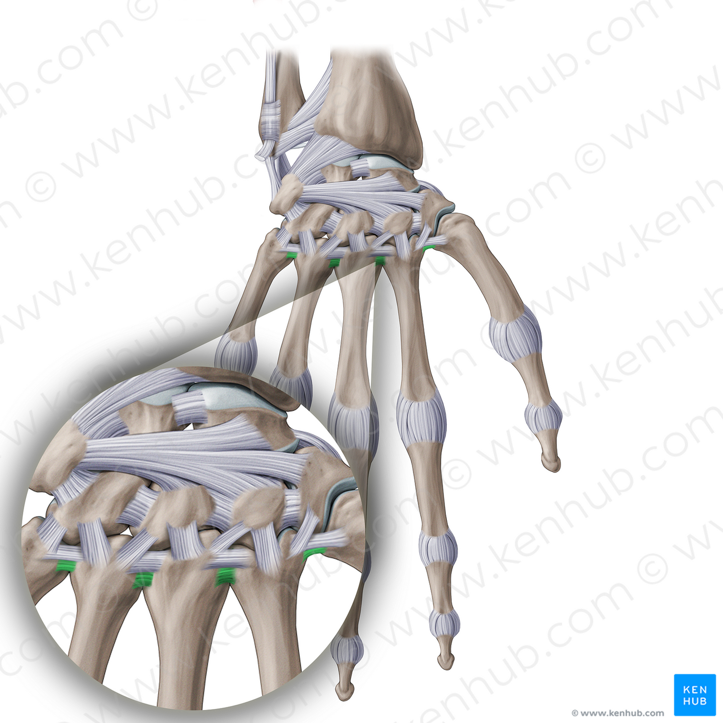 Interosseous metacarpal ligaments (#20253)