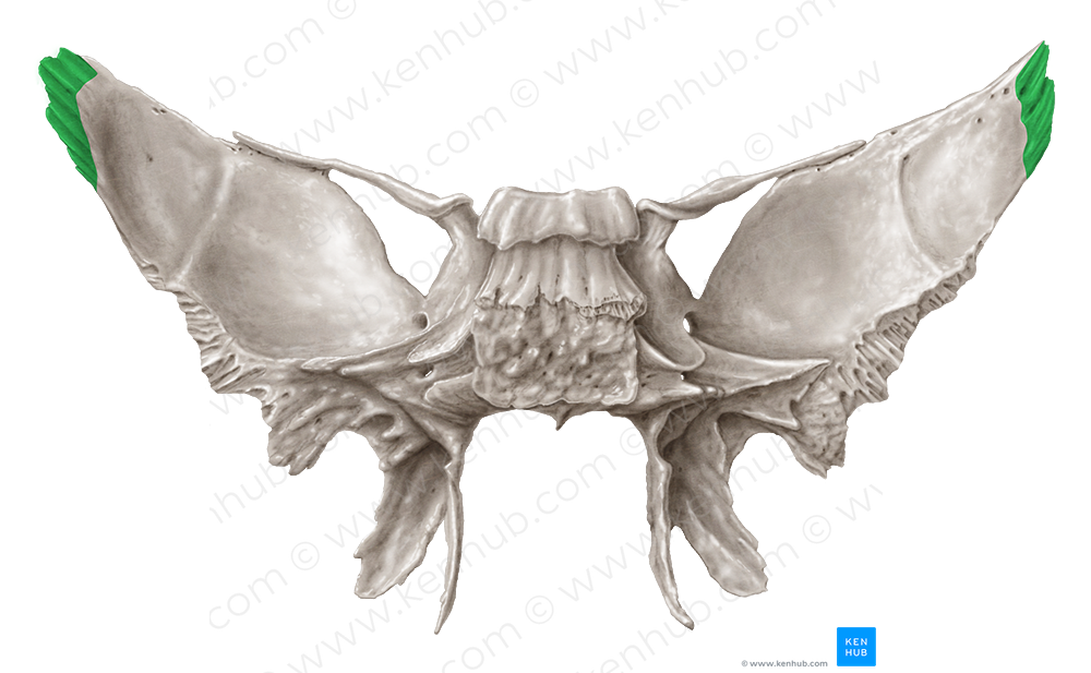 Parietal margin of greater wing of sphenoid bone (#4945)