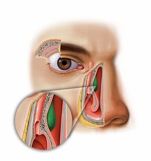 Middle nasal concha of ethmoid bone (#11605)