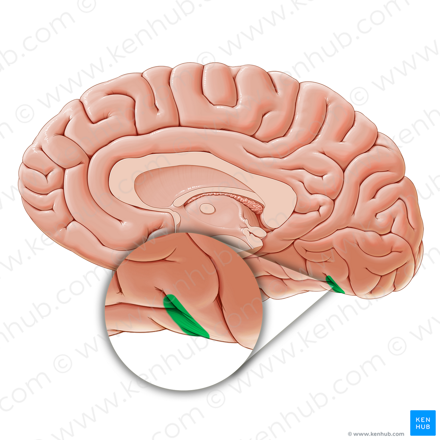 Preoccipital notch (#21174)