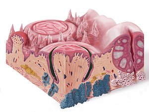 Sulcus of papilla (#9296)