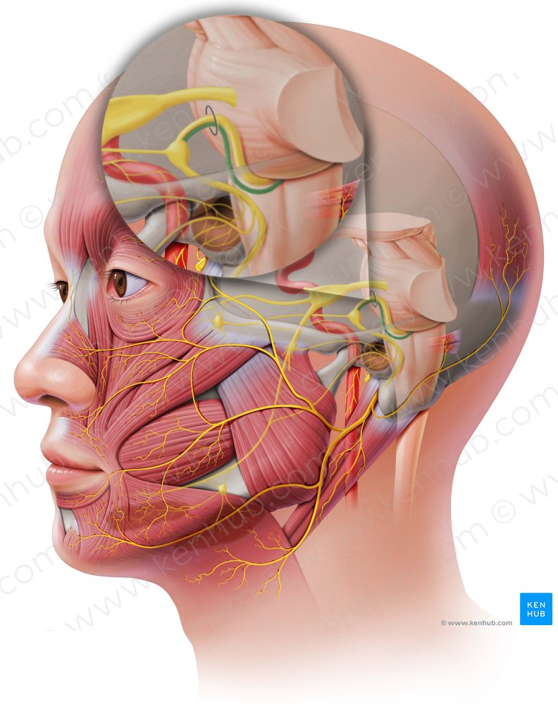 Sensory root of facial nerve (#6492)
