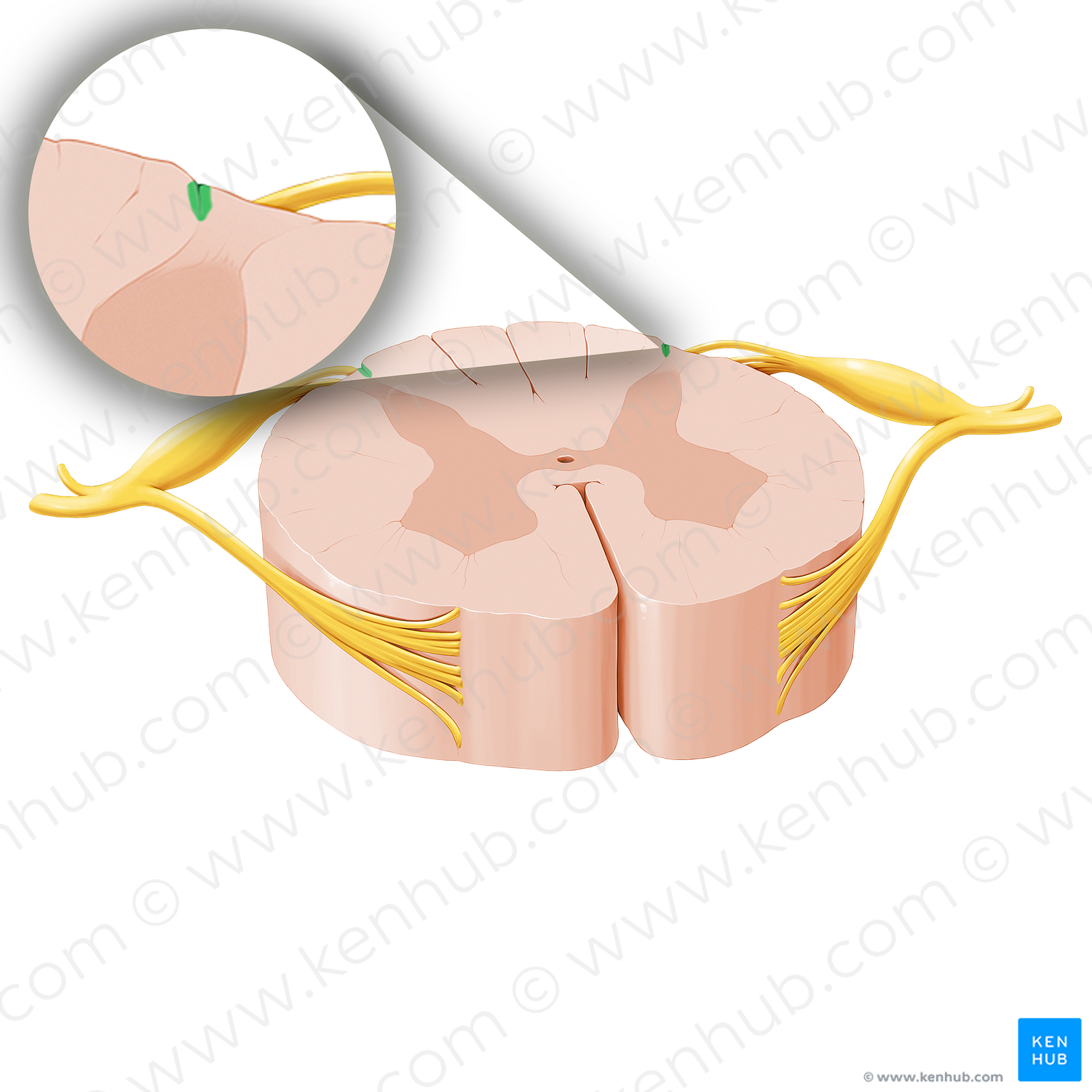 Posterolateral sulcus of spinal cord (#20753)