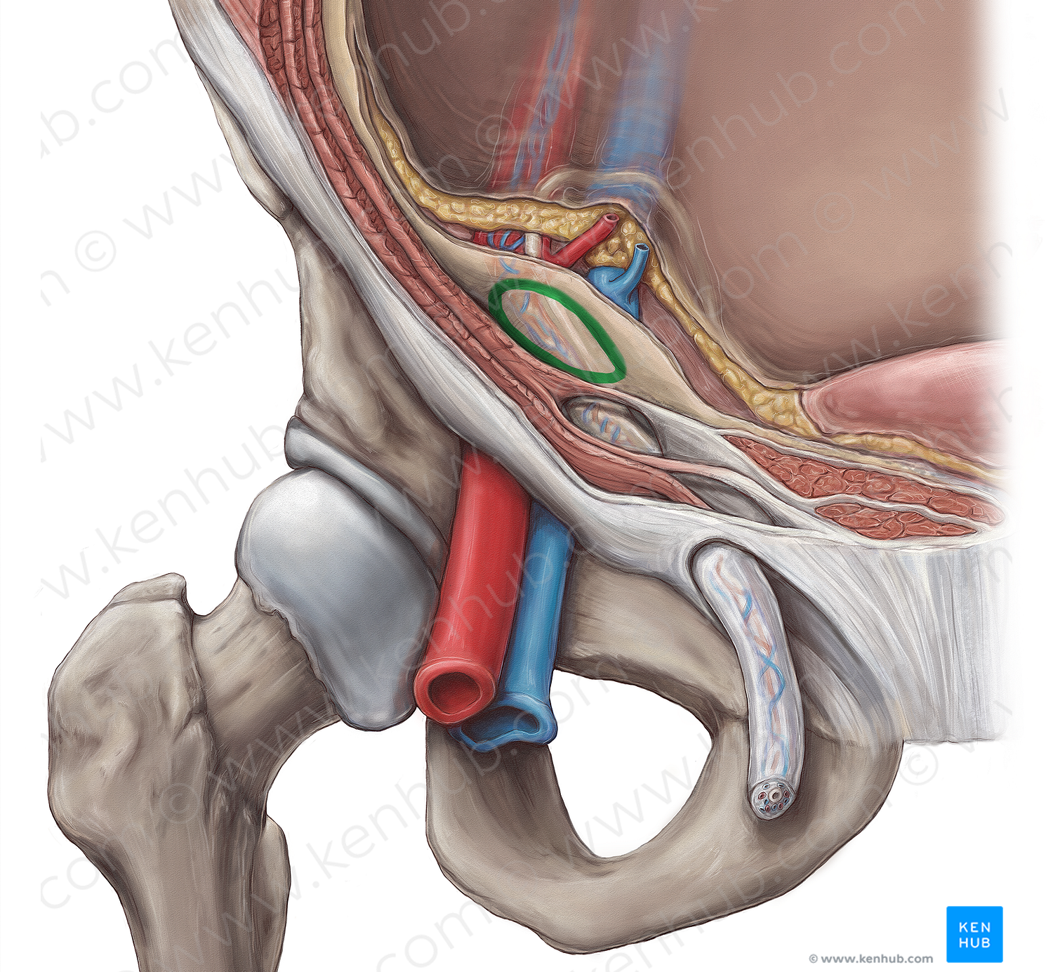 Deep inguinal ring (#14558)