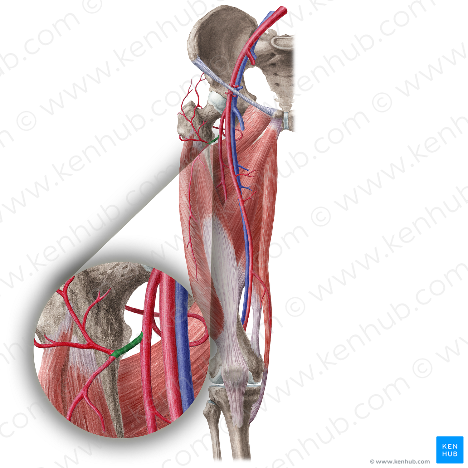 Lateral circumflex femoral artery (#19599)