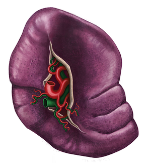 Splenic vein (#10591)