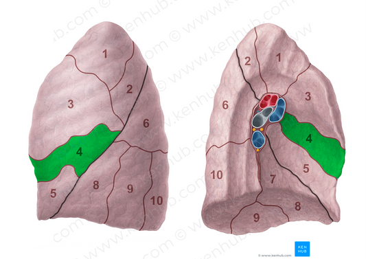 Superior lingular segment of left lung (#20700)