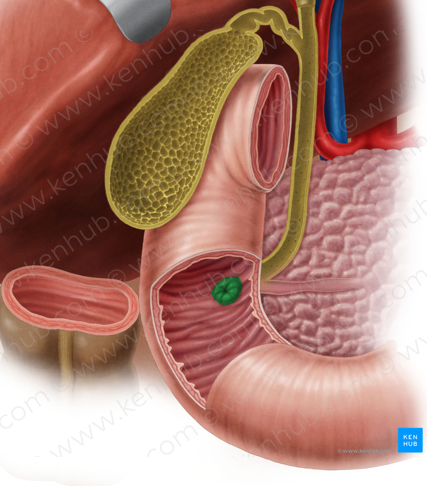 Major duodenal papilla (#7618)