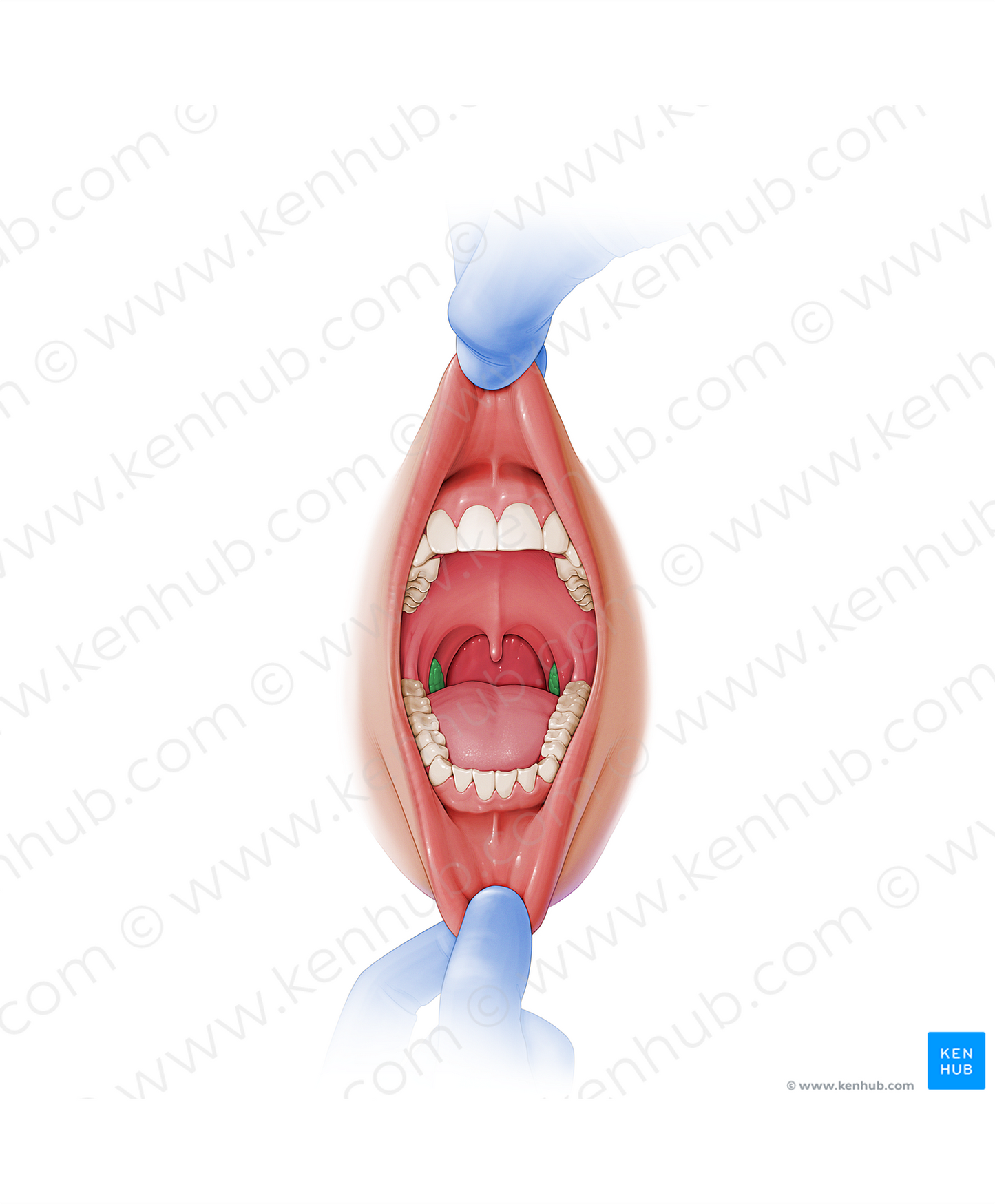 Palatine tonsil (#9474)