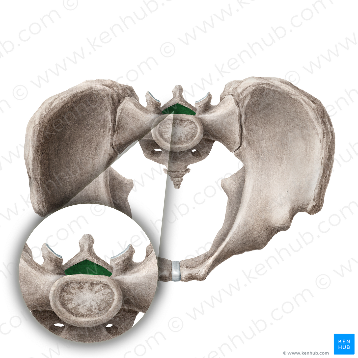 Sacral canal (#21690)