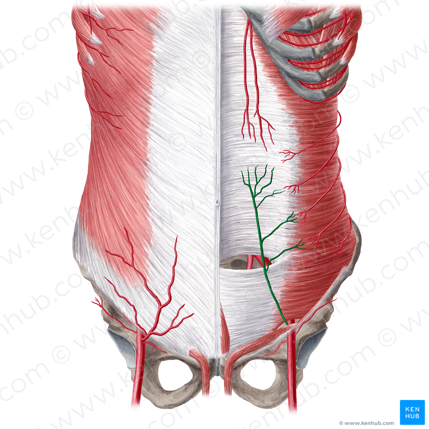 Inferior epigastric artery (#1188)