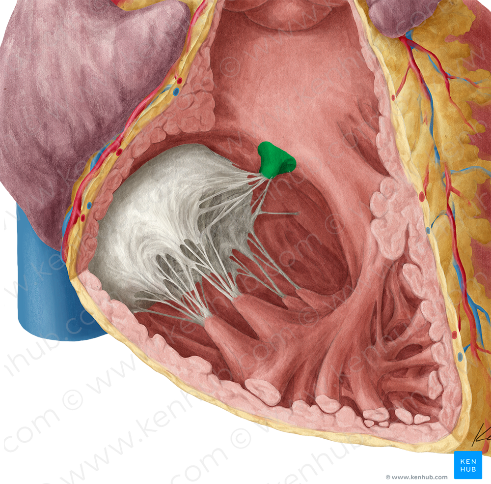 Septal papillary muscle of right ventricle (#5718)