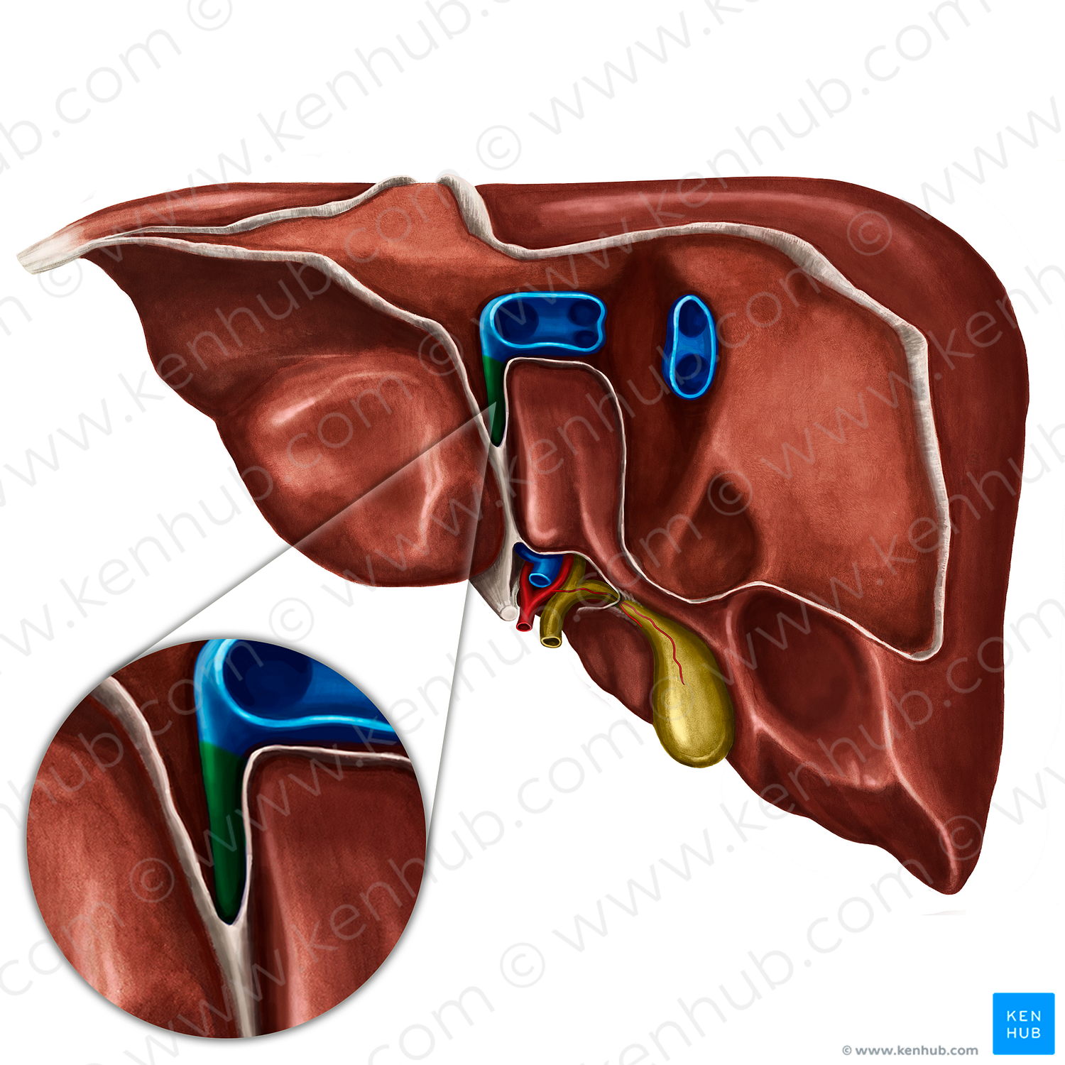 Ligamentum venosum of liver (#4676)