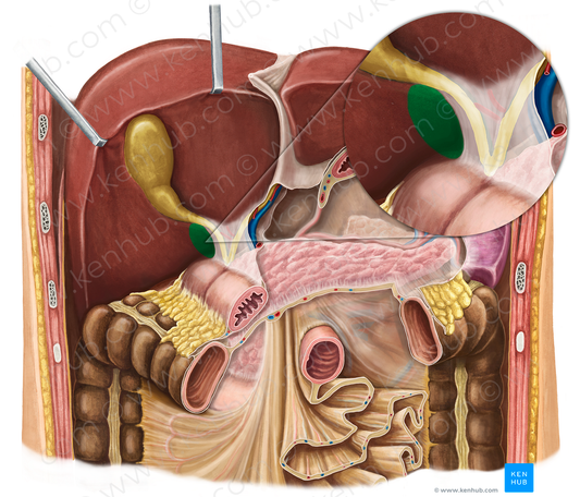 Omental foramen (#3787)